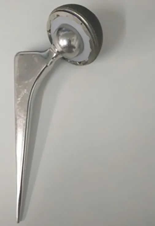 Total Hip Replacement Prosthesis