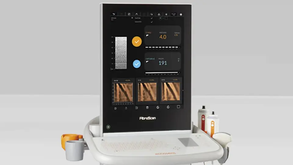 Fibroscan Examination